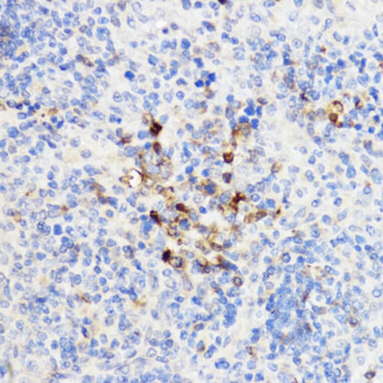 Immunohistochemistry - Anti-YKL-40/CHI3L1 Antibody (A13616) - Antibodies.com