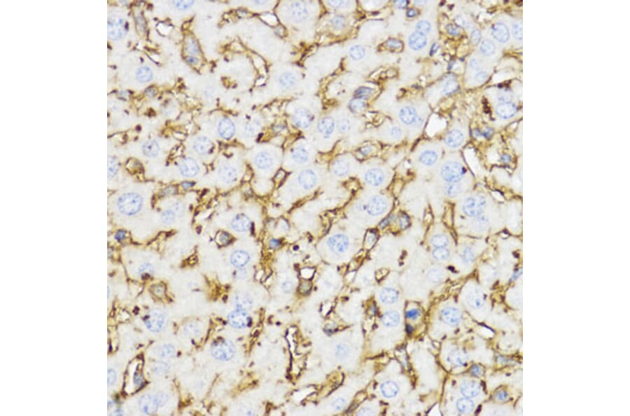 Immunohistochemistry - Anti-YKL-40/CHI3L1 Antibody (A13616) - Antibodies.com