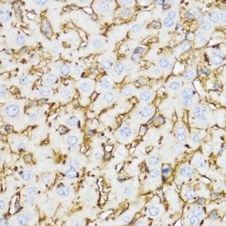 Immunohistochemistry - Anti-YKL-40/CHI3L1 Antibody (A13616) - Antibodies.com