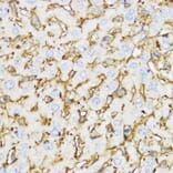 Immunohistochemistry - Anti-YKL-40/CHI3L1 Antibody (A13616) - Antibodies.com