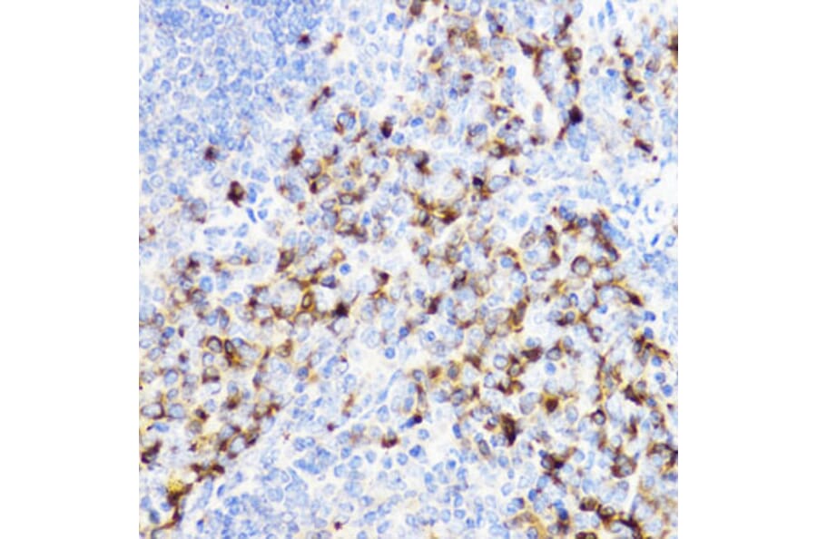 Immunohistochemistry - Anti-YKL-40/CHI3L1 Antibody (A13616) - Antibodies.com