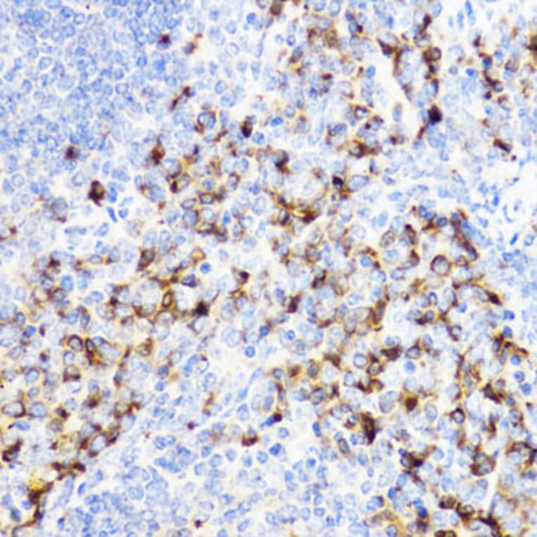 Immunohistochemistry - Anti-YKL-40/CHI3L1 Antibody (A13616) - Antibodies.com