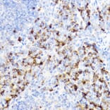 Immunohistochemistry - Anti-YKL-40/CHI3L1 Antibody (A13616) - Antibodies.com