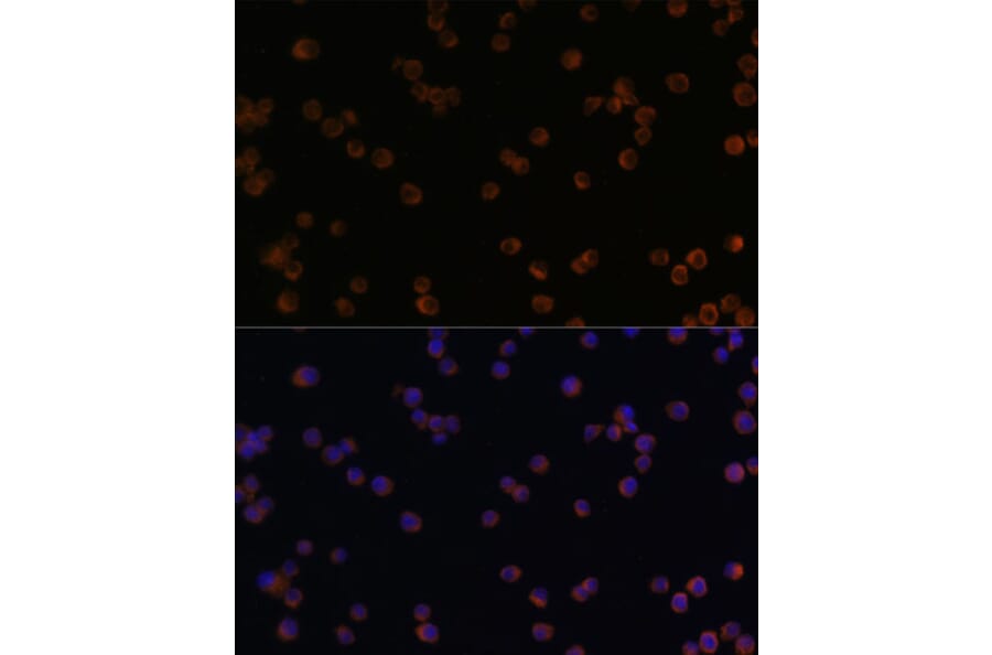 Immunofluorescence - Anti-YKL-40/CHI3L1 Antibody (A13616) - Antibodies.com