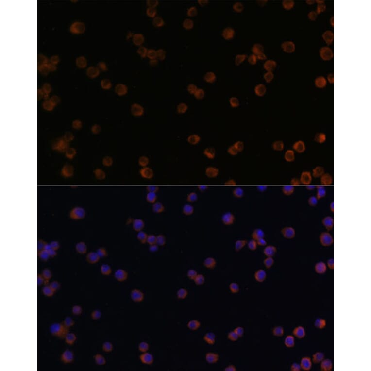 Immunofluorescence - Anti-YKL-40/CHI3L1 Antibody (A13616) - Antibodies.com