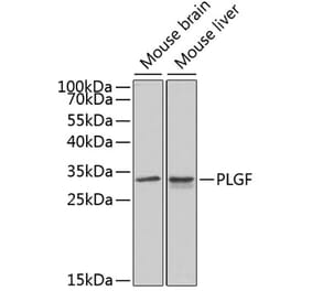 Western Blot - Anti-PLGF Antibody (A13618) - Antibodies.com
