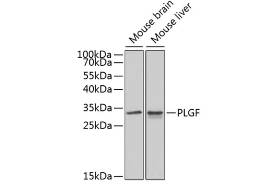 Western Blot - Anti-PLGF Antibody (A13618) - Antibodies.com