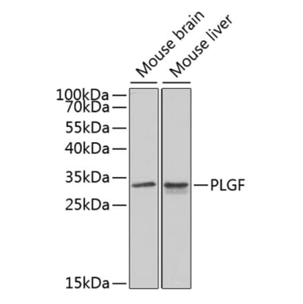 Western Blot - Anti-PLGF Antibody (A13618) - Antibodies.com