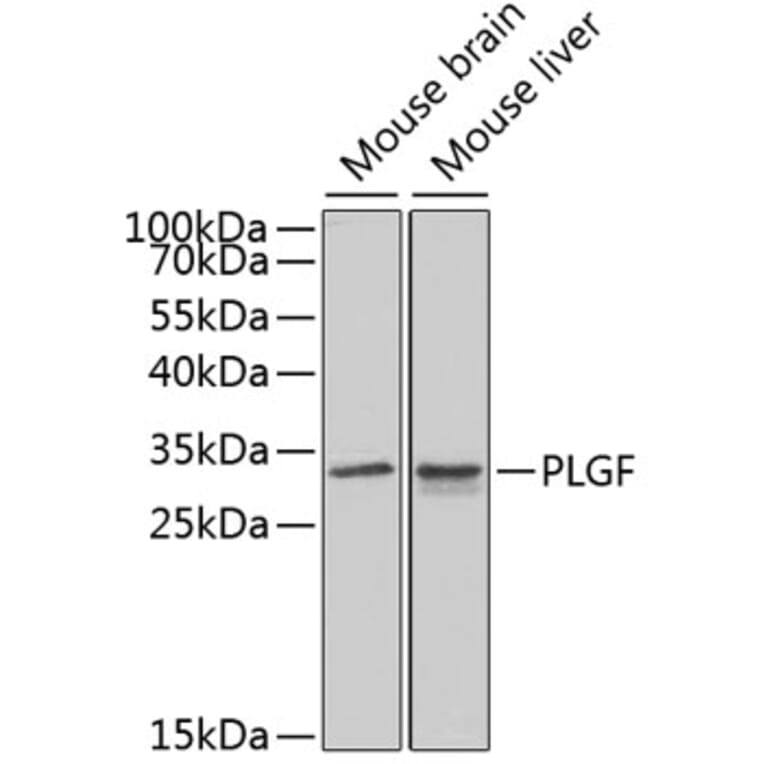 Western Blot - Anti-PLGF Antibody (A13618) - Antibodies.com