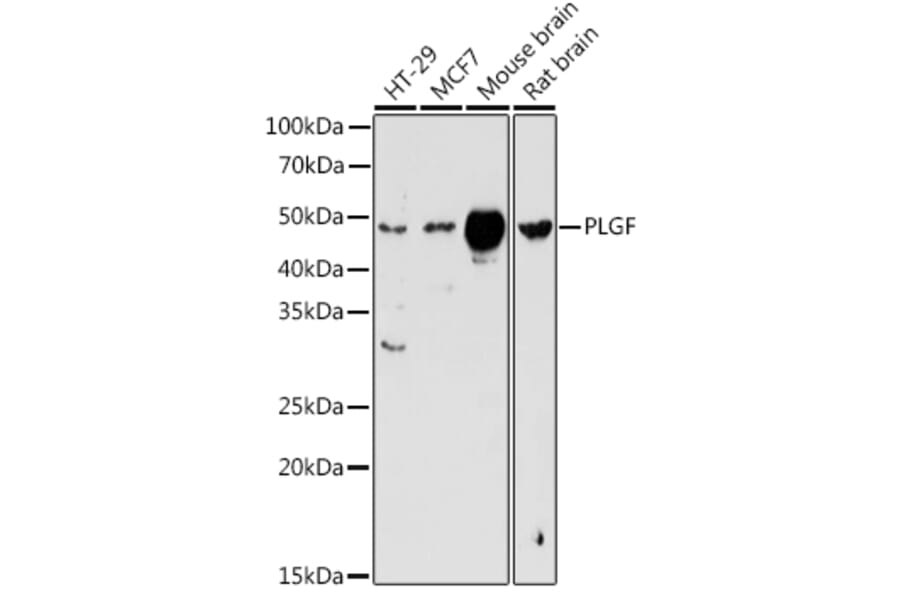 Western Blot - Anti-PLGF Antibody (A13618) - Antibodies.com