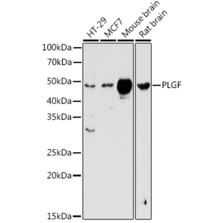 Western Blot - Anti-PLGF Antibody (A13618) - Antibodies.com