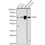 Western Blot - Anti-PLGF Antibody (A13618) - Antibodies.com