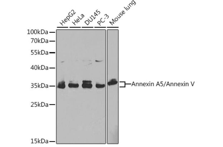 Western Blot - Anti-Annexin V/ANXA5 Antibody (A13619) - Antibodies.com