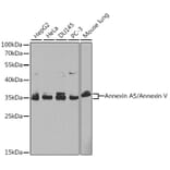 Western Blot - Anti-Annexin V/ANXA5 Antibody (A13619) - Antibodies.com