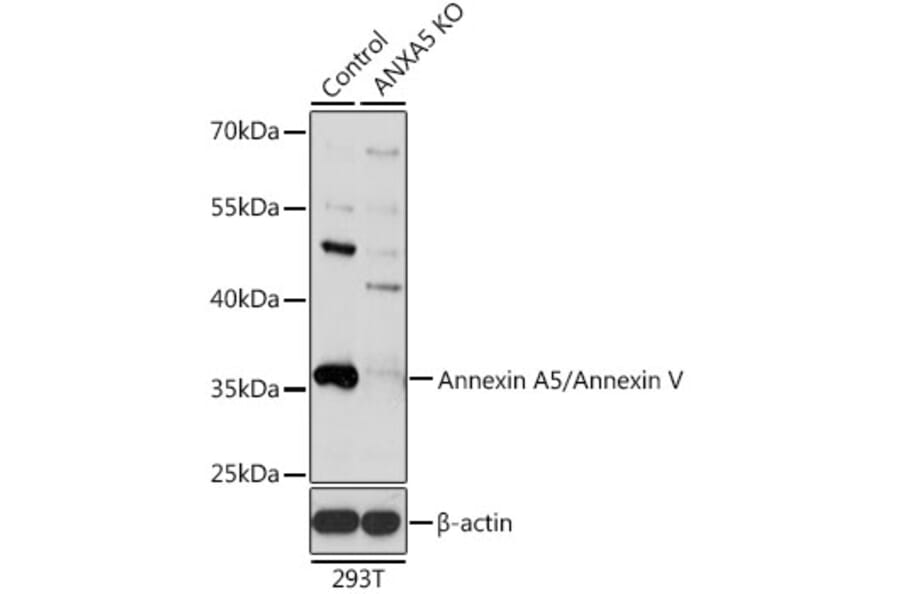Western Blot - Anti-Annexin V/ANXA5 Antibody (A13619) - Antibodies.com