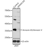 Western Blot - Anti-Annexin V/ANXA5 Antibody (A13619) - Antibodies.com