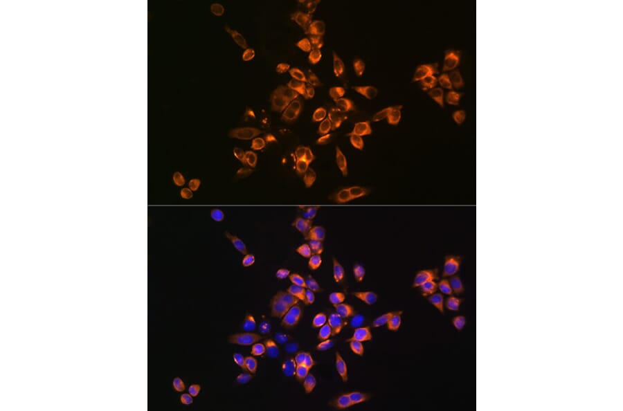 Immunofluorescence - Anti-Annexin V/ANXA5 Antibody (A13619) - Antibodies.com