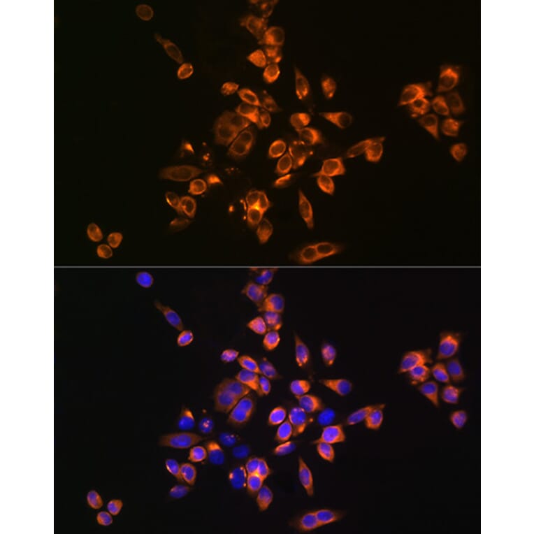 Immunofluorescence - Anti-Annexin V/ANXA5 Antibody (A13619) - Antibodies.com