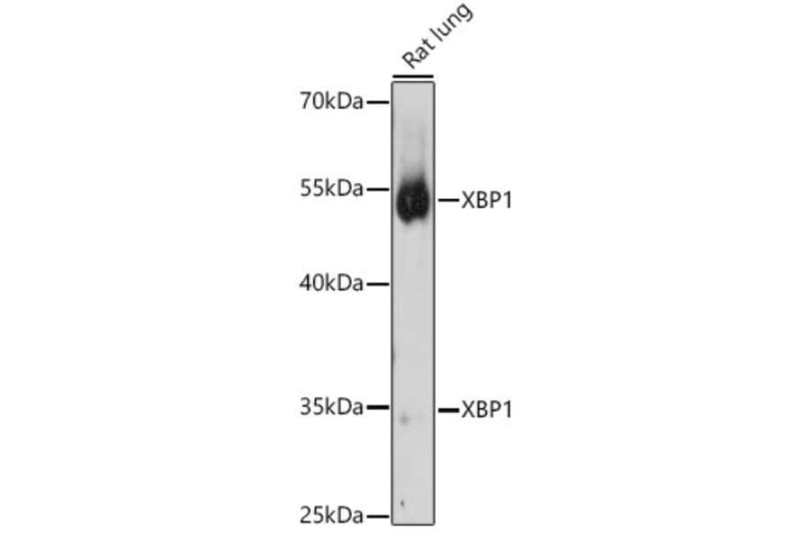 Western Blot - Anti-XBP1 Antibody (A13620) - Antibodies.com