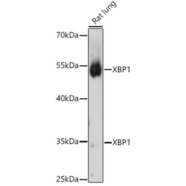 Western Blot - Anti-XBP1 Antibody (A13620) - Antibodies.com