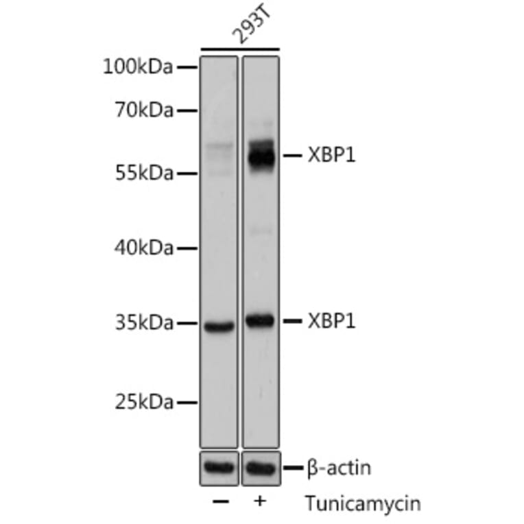 Western Blot - Anti-XBP1 Antibody (A13620) - Antibodies.com