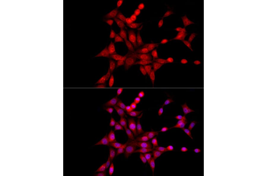 Immunofluorescence - Anti-XBP1 Antibody (A13620) - Antibodies.com