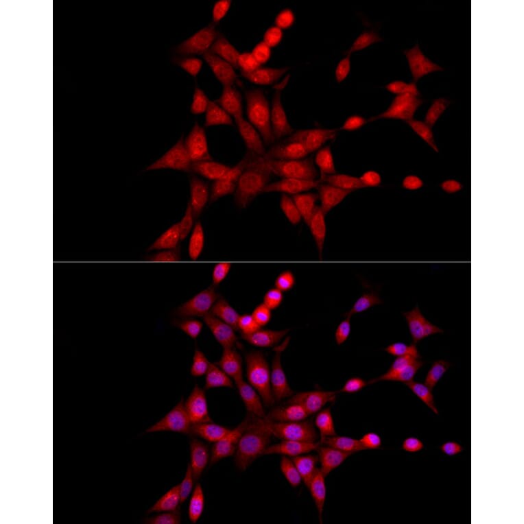 Immunofluorescence - Anti-XBP1 Antibody (A13620) - Antibodies.com