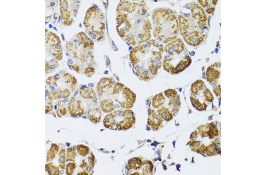 Immunohistochemistry - Anti-HDAC6 Antibody (A13621) - Antibodies.com