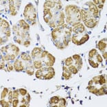 Immunohistochemistry - Anti-HDAC6 Antibody (A13621) - Antibodies.com