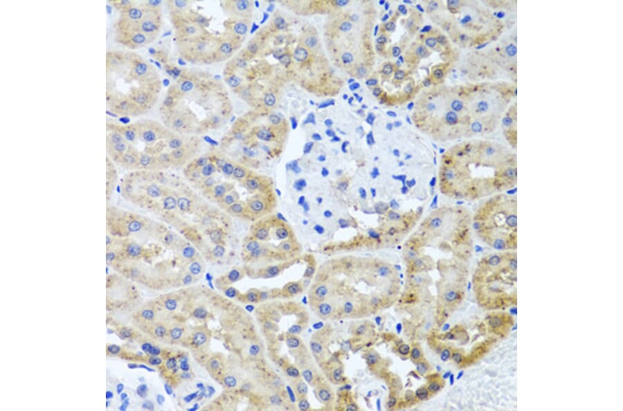 Immunohistochemistry - Anti-HDAC6 Antibody (A13621) - Antibodies.com