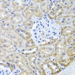 Immunohistochemistry - Anti-HDAC6 Antibody (A13621) - Antibodies.com
