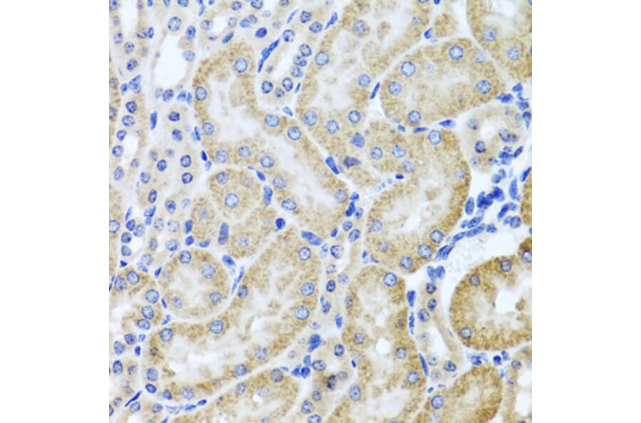Immunohistochemistry - Anti-HDAC6 Antibody (A13621) - Antibodies.com