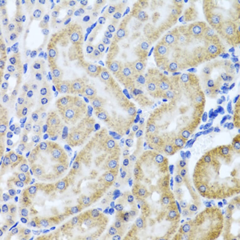 Immunohistochemistry - Anti-HDAC6 Antibody (A13621) - Antibodies.com