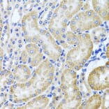 Immunohistochemistry - Anti-HDAC6 Antibody (A13621) - Antibodies.com