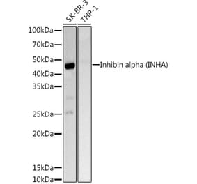 Western Blot - Anti-Inhibin alpha Antibody (A13623) - Antibodies.com