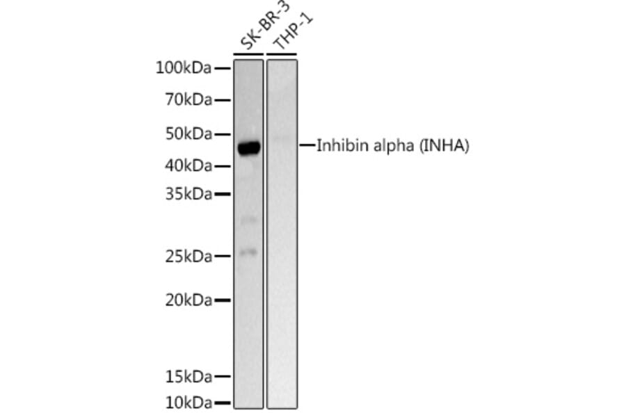 Western Blot - Anti-Inhibin alpha Antibody (A13623) - Antibodies.com