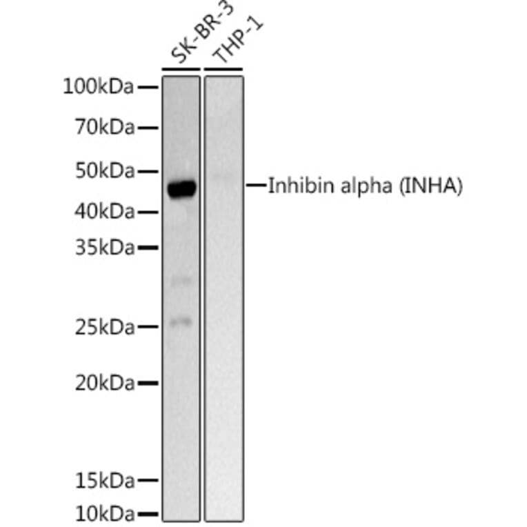 Western Blot - Anti-Inhibin alpha Antibody (A13623) - Antibodies.com