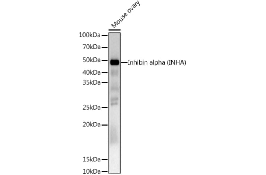 Western Blot - Anti-Inhibin alpha Antibody (A13623) - Antibodies.com