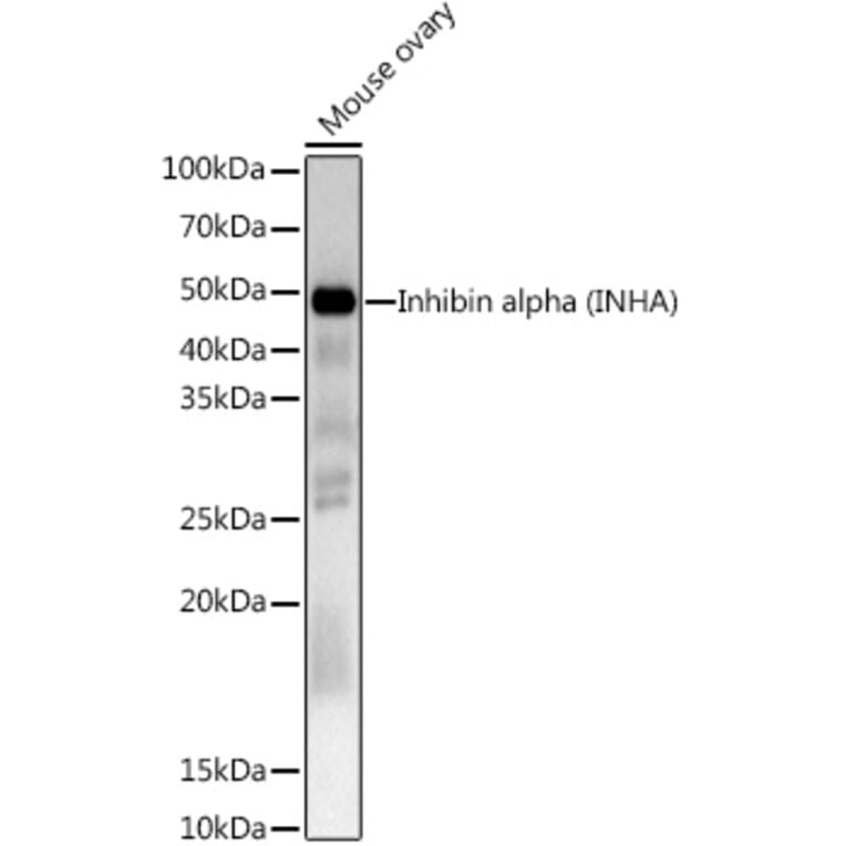 Western Blot - Anti-Inhibin alpha Antibody (A13623) - Antibodies.com