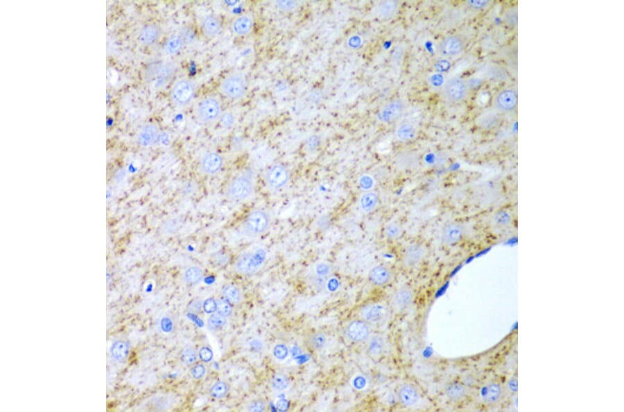 Immunohistochemistry - Anti-Inhibin alpha Antibody (A13623) - Antibodies.com