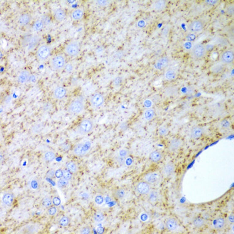 Immunohistochemistry - Anti-Inhibin alpha Antibody (A13623) - Antibodies.com