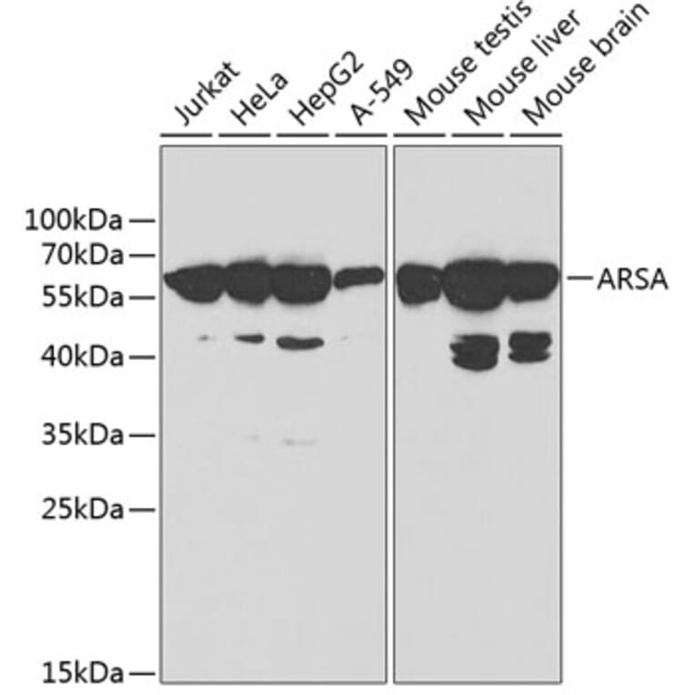 Western Blot - Anti-ARSA/ASA Antibody (A13624) - Antibodies.com