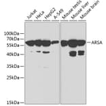 Western Blot - Anti-ARSA/ASA Antibody (A13624) - Antibodies.com
