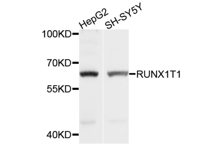 Western Blot - Anti-RUNX1T1 Antibody (A1737) - Antibodies.com