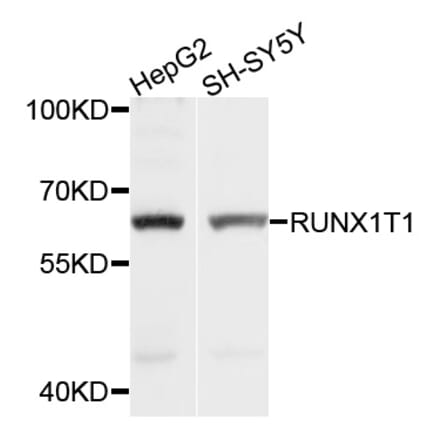 Western Blot - Anti-RUNX1T1 Antibody (A13625) - Antibodies.com