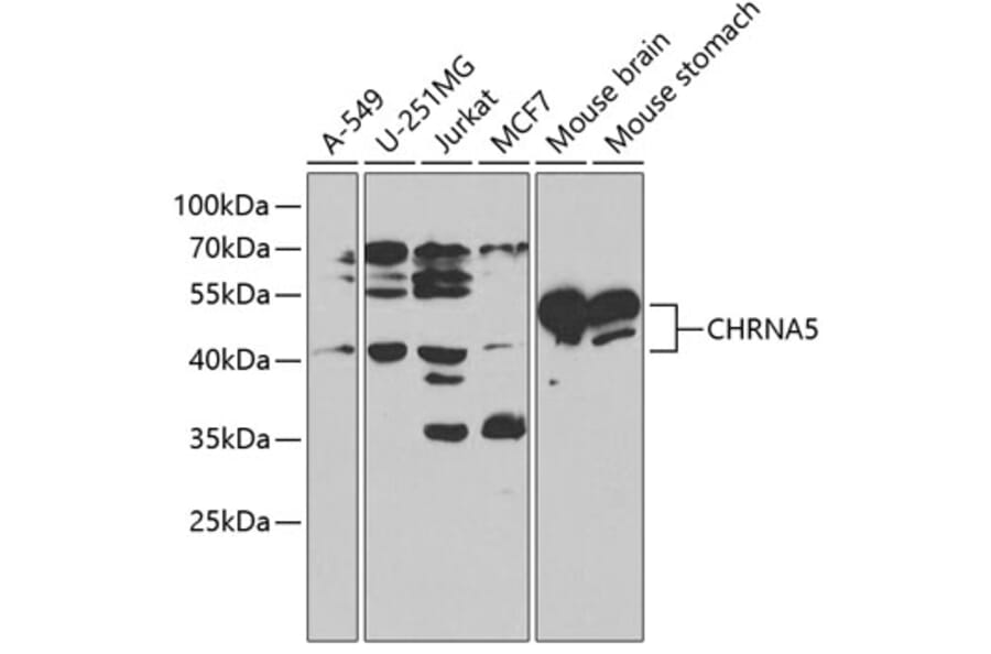 Western Blot - Anti-Nicotinic Acetylcholine Receptor alpha 5/CHRNA5 Antibody (A13626) - Antibodies.com