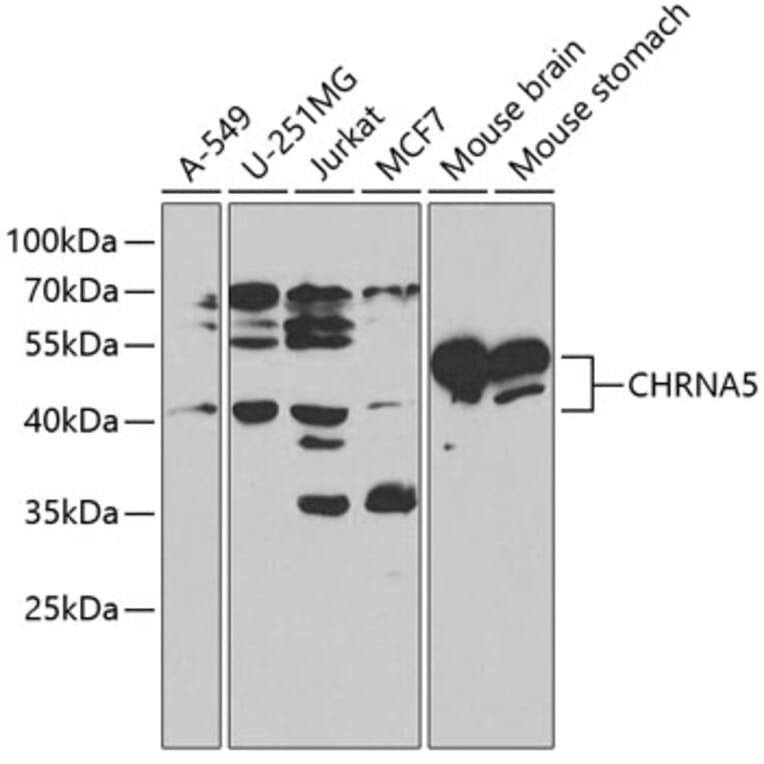 Western Blot - Anti-Nicotinic Acetylcholine Receptor alpha 5/CHRNA5 Antibody (A13626) - Antibodies.com