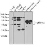 Western Blot - Anti-Nicotinic Acetylcholine Receptor alpha 5/CHRNA5 Antibody (A13626) - Antibodies.com