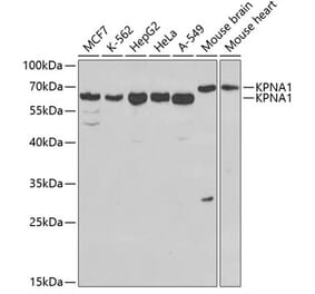 Western Blot - Anti-KPNA1 Antibody (A13627) - Antibodies.com