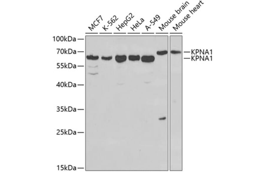 Western Blot - Anti-KPNA1 Antibody (A13627) - Antibodies.com